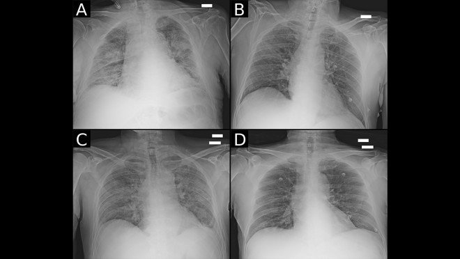 Diagnostic imagery of a lung, illustrating work as part of AWS Diagnostic Data Initiative