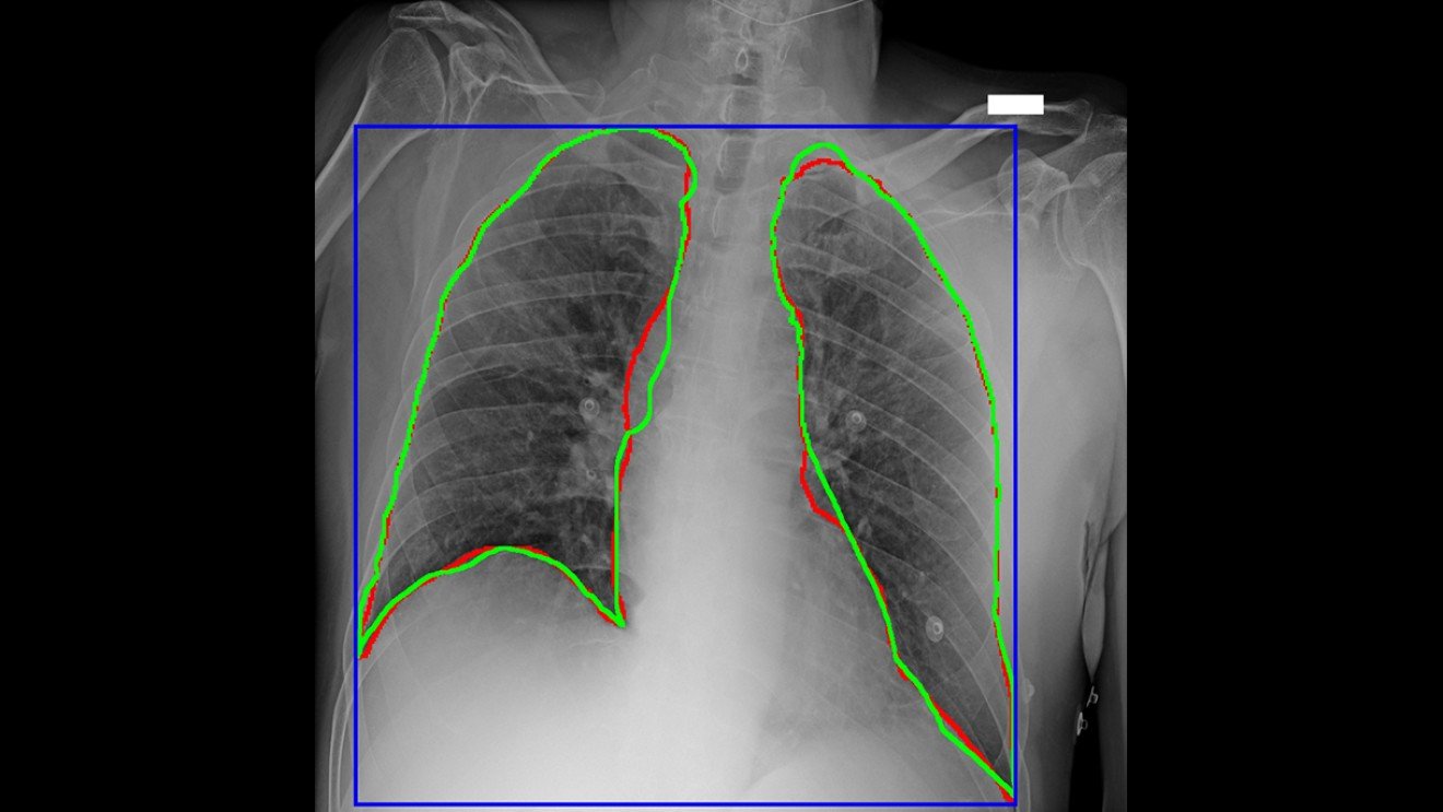 Diagnostic imagery of a lung, illustrating work as part of AWS Diagnostic Data Initiative