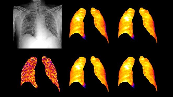 Diagnostic imagery of a lung, illustrating work as part of AWS Diagnostic Data Initiative